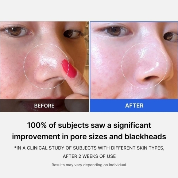 Medicube Zero Pore Pad - Picture 7 of 13